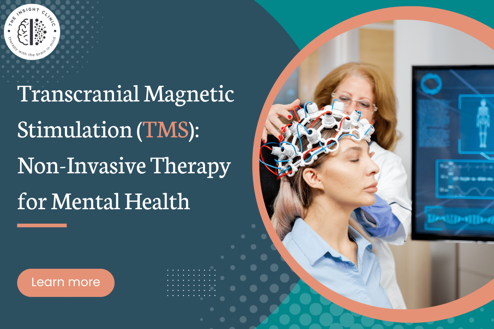 Transcranial Magnetic Stimulation Non Invasive Mental Health Therapy Transcranial Magnetic Stimulation Non Invasive Mental Health Therapy